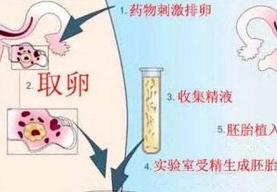 胰岛素抵抗如何影响生育力？ 发生胰岛素抵抗该怎么办？ 多囊姐妹容易忽略的导致流产的原因