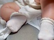 高龄女性做三代试管需要注意什么？